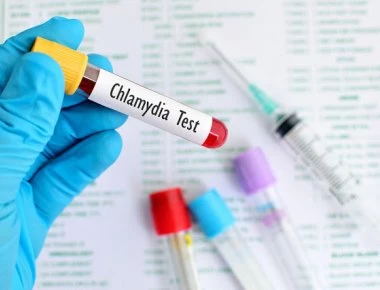 Αν εντοπίσετε αυτά τότε έχετε χλαμύδια – Προσοχή στα σημάδια